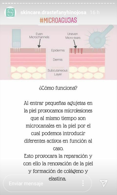 Pin By Daniela Ovando Paz On Cosmetologia Microneedling