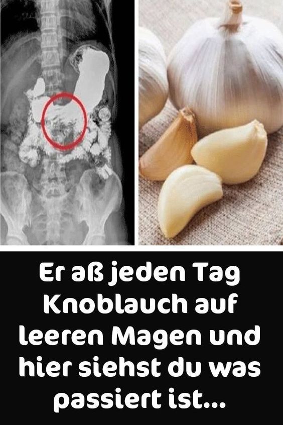 Knoblauch auf nüchternen Magen essen, um Gewicht zu verlieren