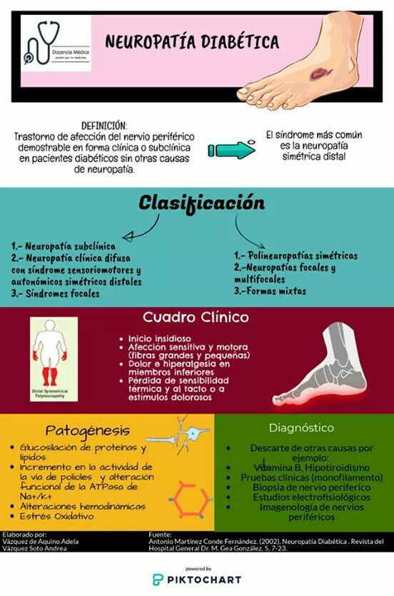 polineuropatía diabética simétrica distal