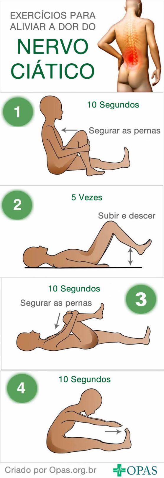 Infográfico Aliviando as Dores do Nervo Ciático