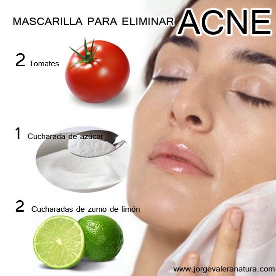 Mascarilla Para Eliminar Acné 2 Tomates 1 Cucharada De Azúcar 2 Cucharadas De Zumo De Limón Lav Eliminar Acné Mascarillas Para La Piel Consejos Para La Piel