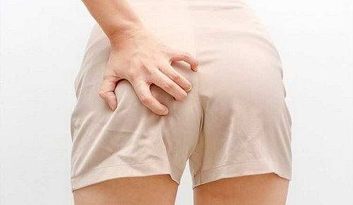 Ngứa Hậu Mon La Bệnh Gi Cach điều Trị Phong Kham Trĩ Kien Thanh Sức Khỏe Ngựa Chất Beo