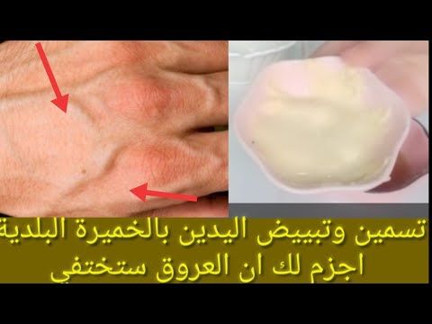 عروق ايديك كبانوا وصفة لتسمين اليدين والخدود في نفس الوقت كتبيض Youtube Clean Skin Face Face Skin Clean Skin