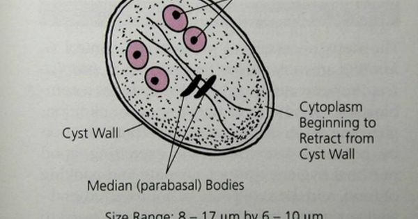 Mit nem szabad enni a giardiasis kezelésében