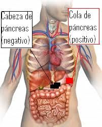 Terapia de imanes para adelgazar