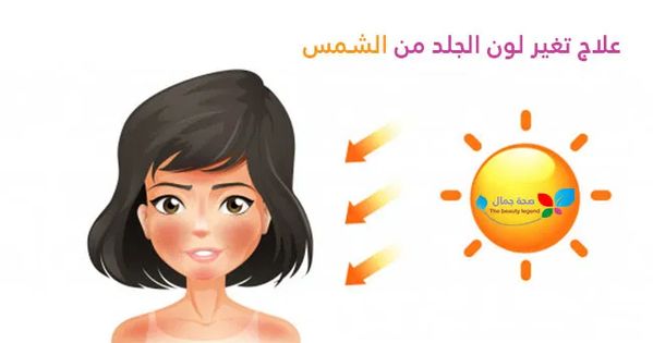علاج تغير لون الجلد من الشمس ماهي أفضل الطرق المضمونة لعلاج اسمرار البشرة Sehajmal Movie Posters Poster Movies