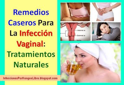 Cómo curar la infección por hongos en el cuello