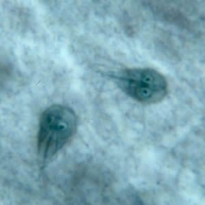 Giardia cdc dpdx