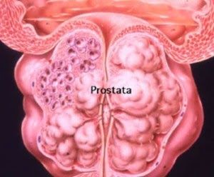 ce medicamente împotriva viermilor și viermilor