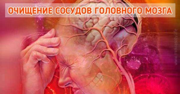 очищение сосудов головного мозга 5 лучших народных средств Migraine Headaches Natural Headache Remedies Migraine