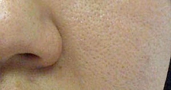 Pin En Belleza Salud