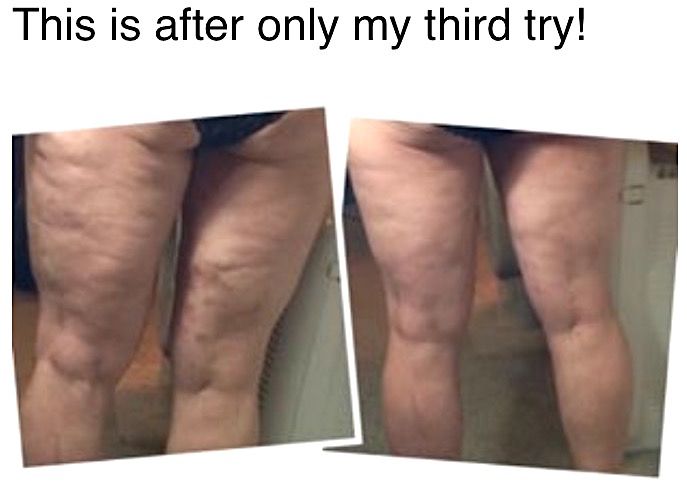 Fascia blaster coupon code