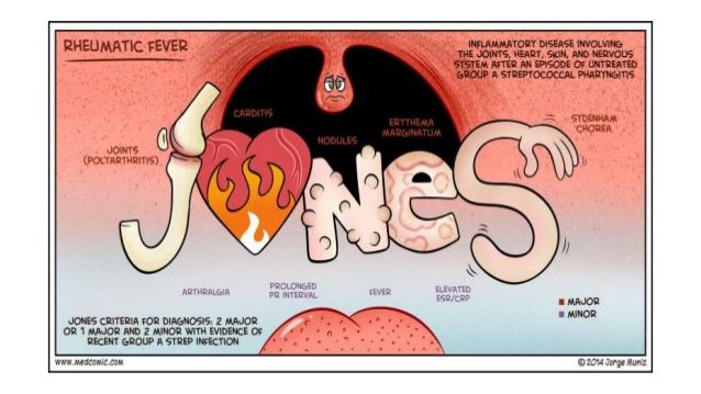 Nursing Journals About Kawasaki Disease Nursing Journals About Kawasaki Disease
