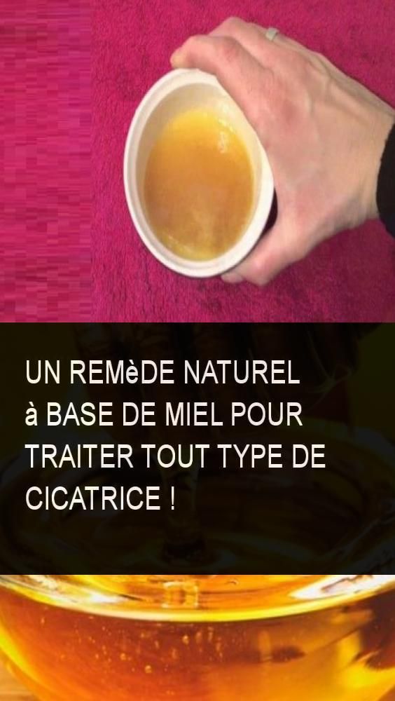 Un remède naturel à base de Miel pour traiter tout type de ... Un remède naturel à base de Miel pour traiter tout type de ...
