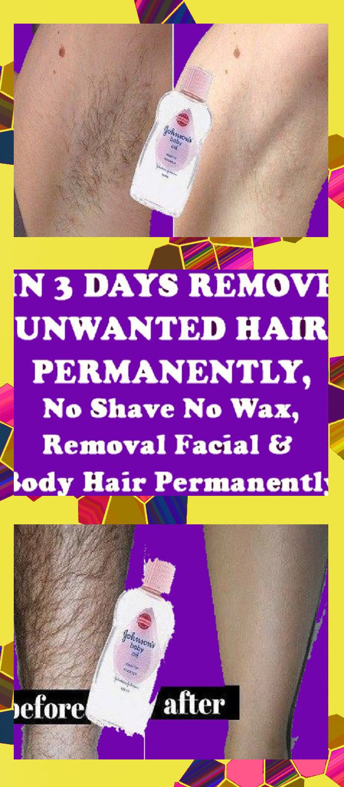 Remove Unwanted Hair Permanently In Three Days No Shave No Wax Removal Facial Body Hair Perma In 2020 Unwanted Hair Removal Unwanted Hair Permanently Unwanted Hair