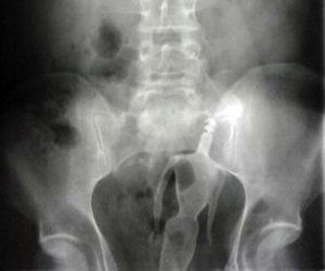 Free fat ass vids Weird things stuck in her ass