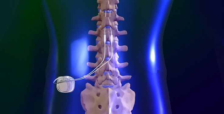 Glass Back Spinal Illness Glass Back Spinal Illness