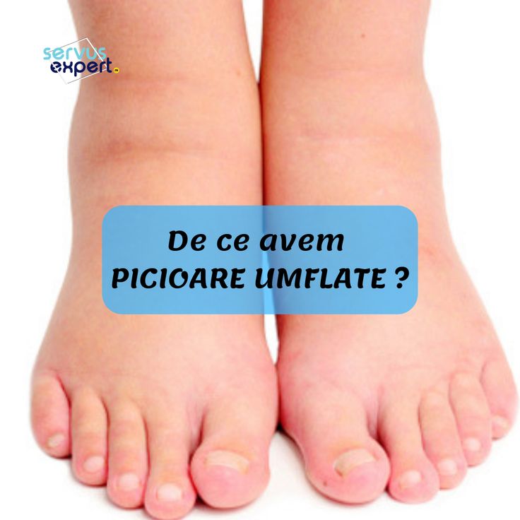 mamoplastie cu vene varicoase