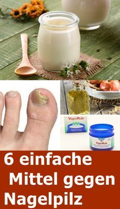 6 einfache Mittel gegen Nagelpilz
