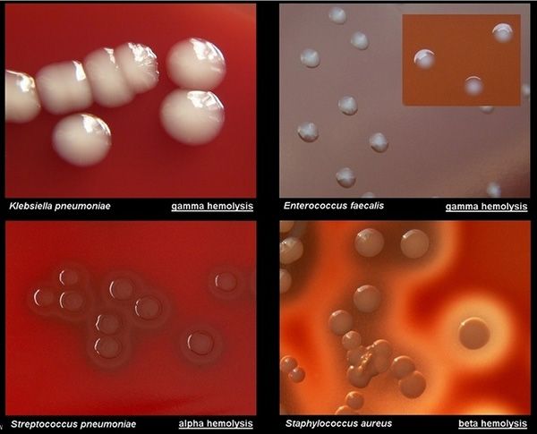 medical laboratory technician medical laboratory technician