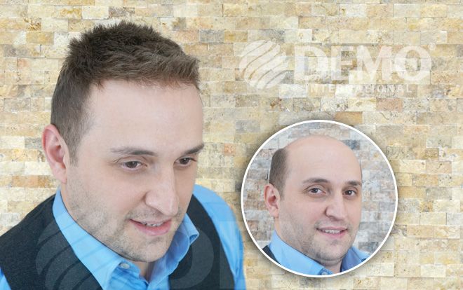 Demo Hair Volkan S Sac Volkanlar Galeri Demo Hair Volkan S Sac Volkanlar Galeri
