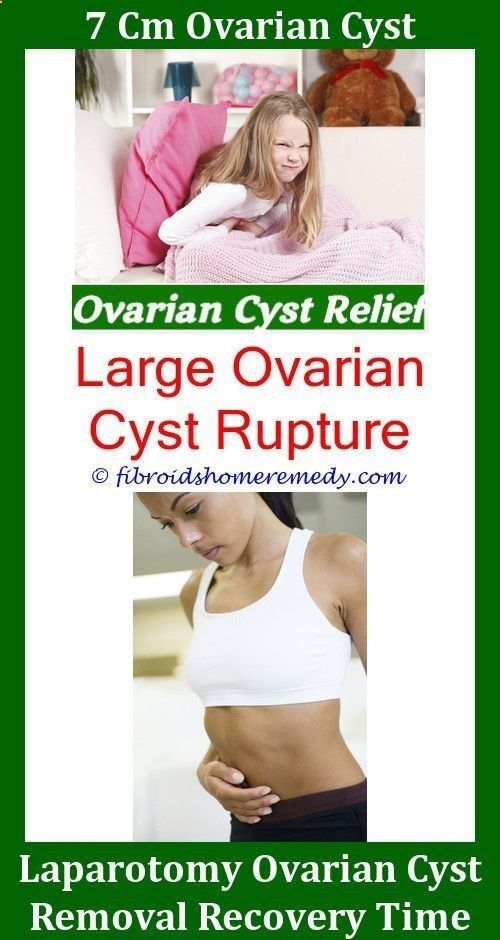 ovarian cyst remedies ovarian cyst remedies signs and symptoms