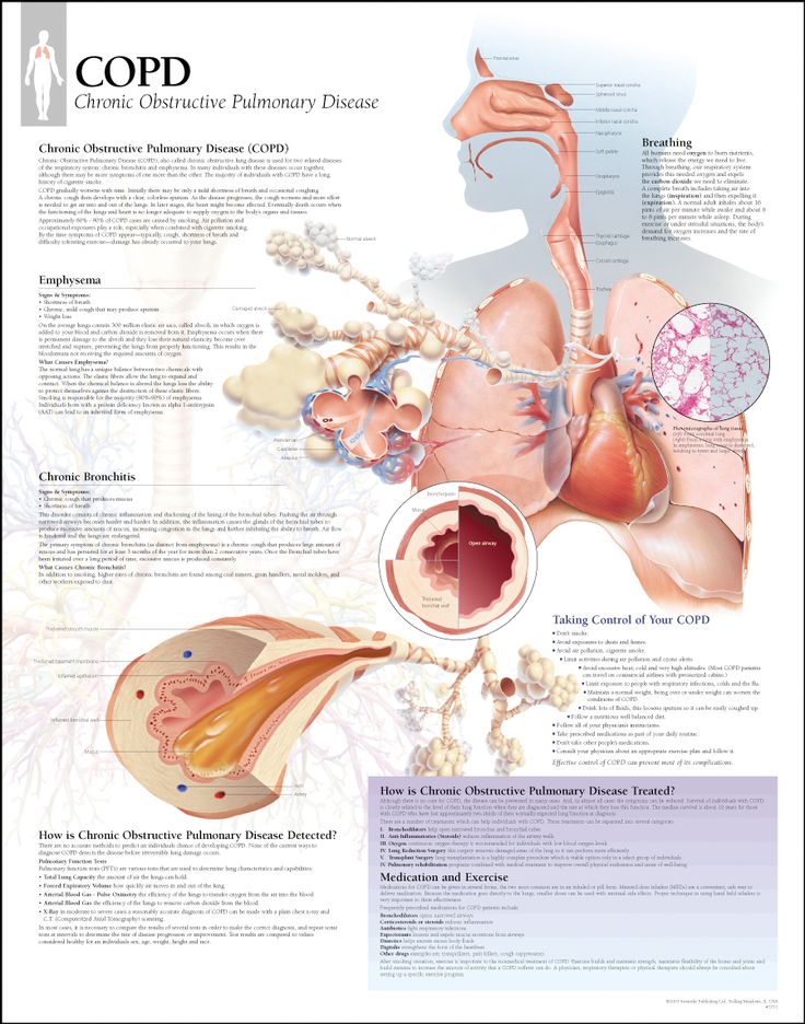 27 best copd images on pinterest respiratory system respiratory how does mucus form