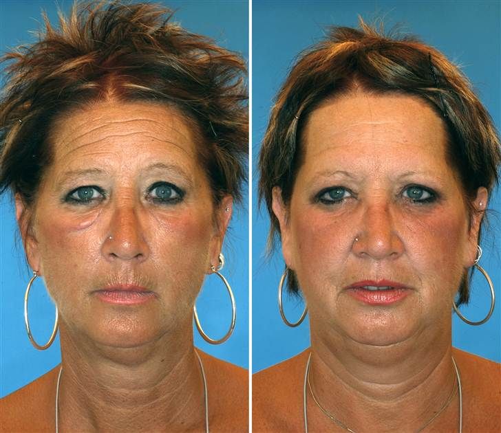 Arbonne skin care dr. phils sister in law facial scars Dc bdsm scene