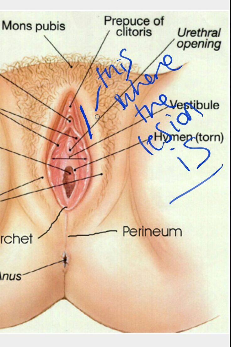 Confirm. Lesions vagina vulva comfort! Very Lesions vagina vulva regret