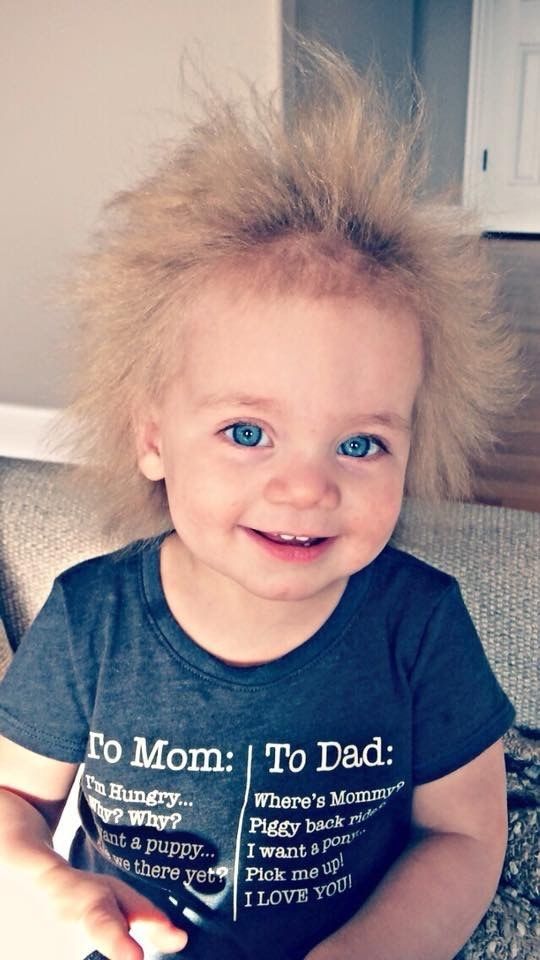 Uncombable Hair Syndrome Is A Real, Super Rare Genetic Condition And