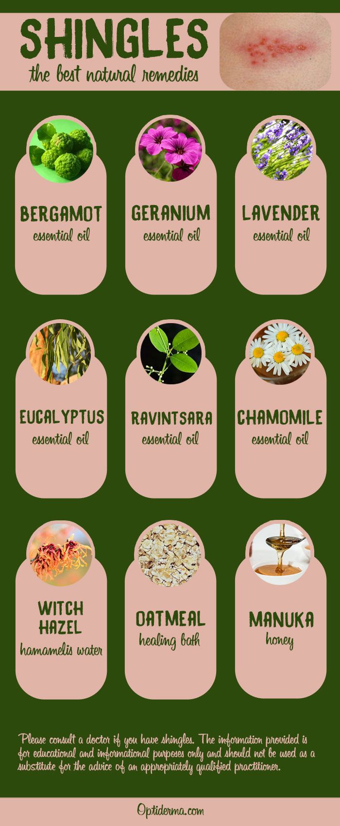 gel nails protecting your nails from overexposure to chemicals and allergic reactions 89 best herbal remedies for skin images on pinterest herbal gel nails protecting your nails from overexposure to chemicals and allergic reactions 89 best herbal remedies for skin images on pinterest herbal
