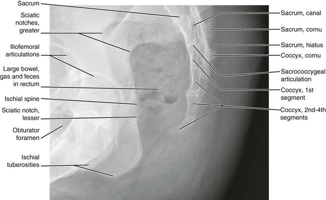 Normal Anatomy | Radiology Key | Radiology imaging, Radiology, Anatomy