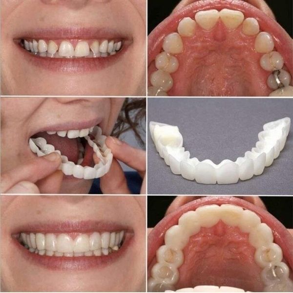 How To Make Your Bottom Dentures Fit Better How to Guide