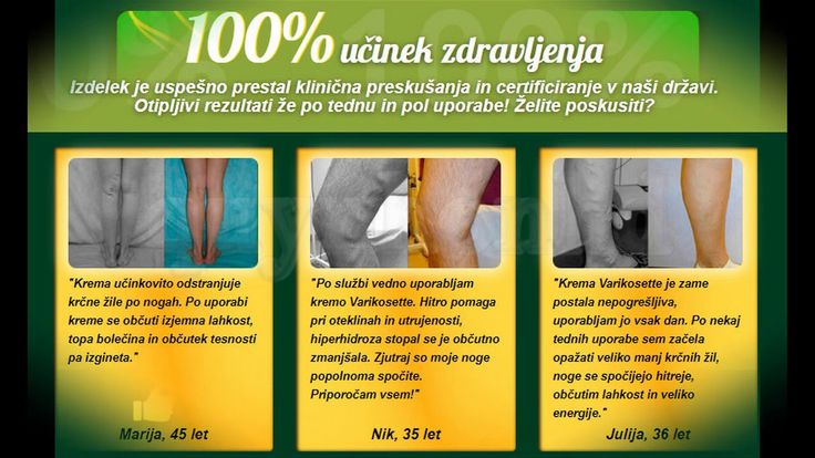 preparate de tratament de venă varicoză