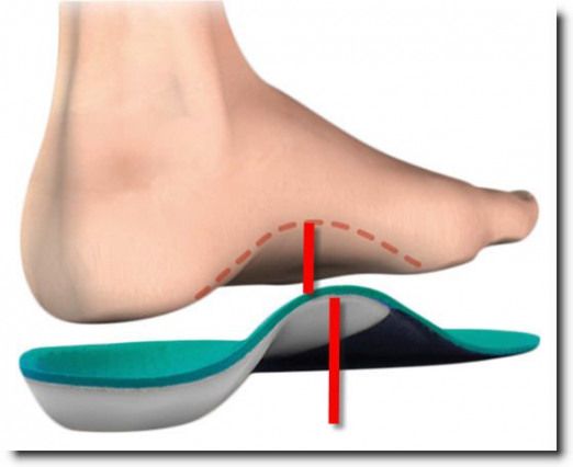 Plantar Fasciitis Stretches | plantar fascitis | Massage Therapy Works