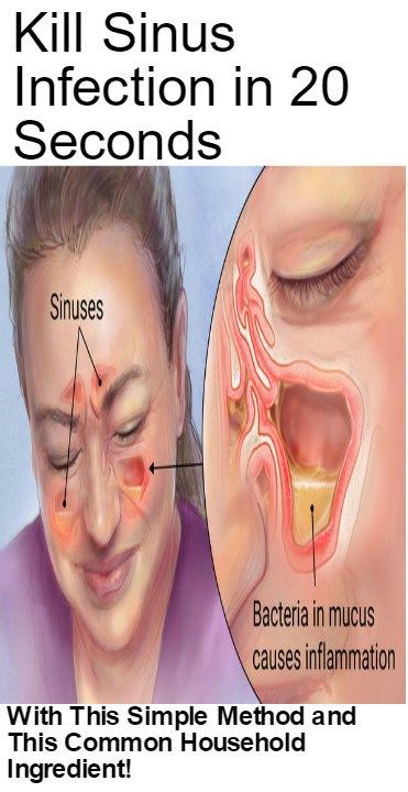 Natural Cure For Sinus Drainage Natural Cure For Sinus Drainage