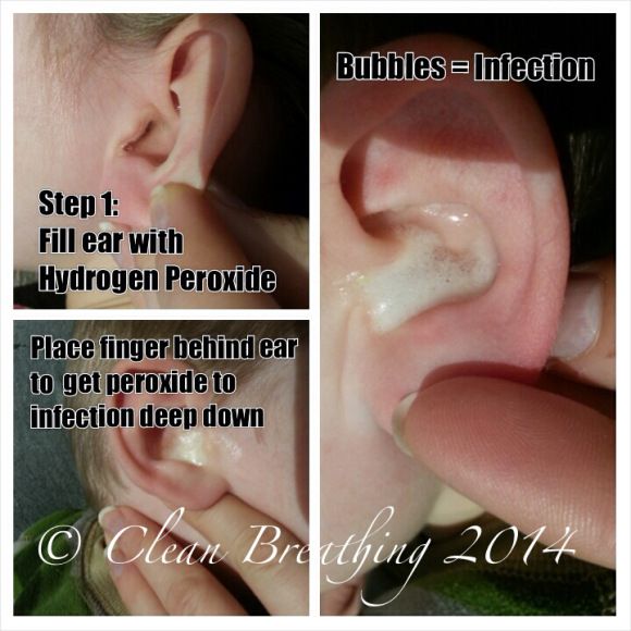Natural Remedies Ear Infection Natural Remedies Ear Infection