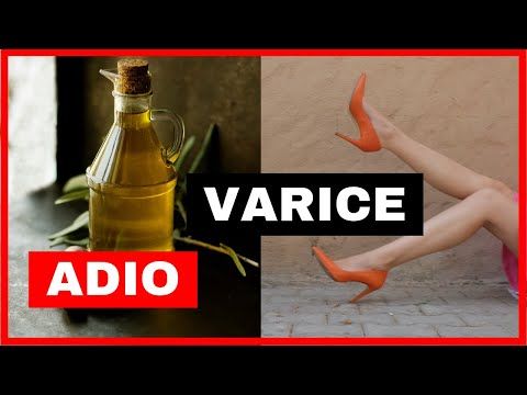 colita viena pe picior cu varicoza