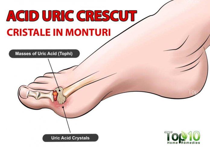 Când articulațiile picioarelor și brațelor doare Durerile de membre – cum pot fi combatute?