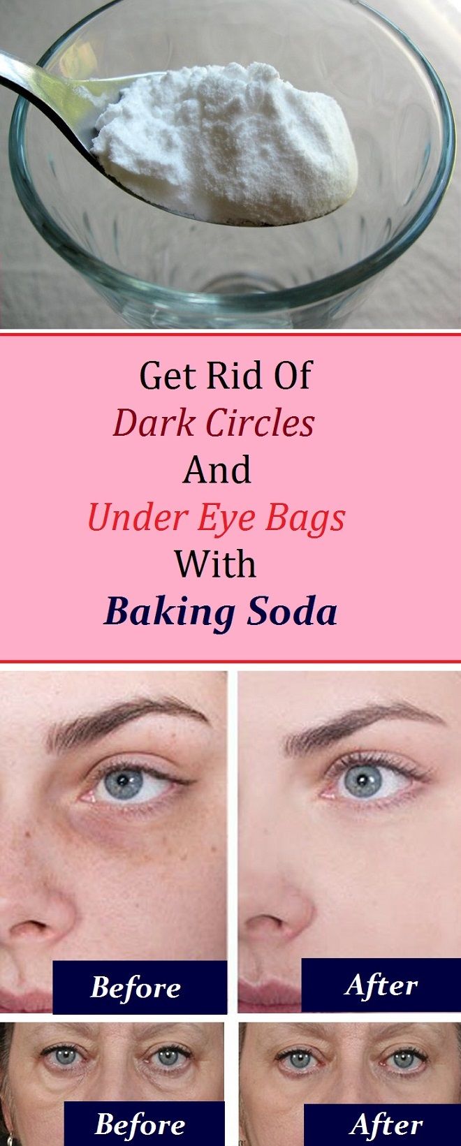 Under Eye Bag Treatment Natural Under Eye Bag Treatment Natural