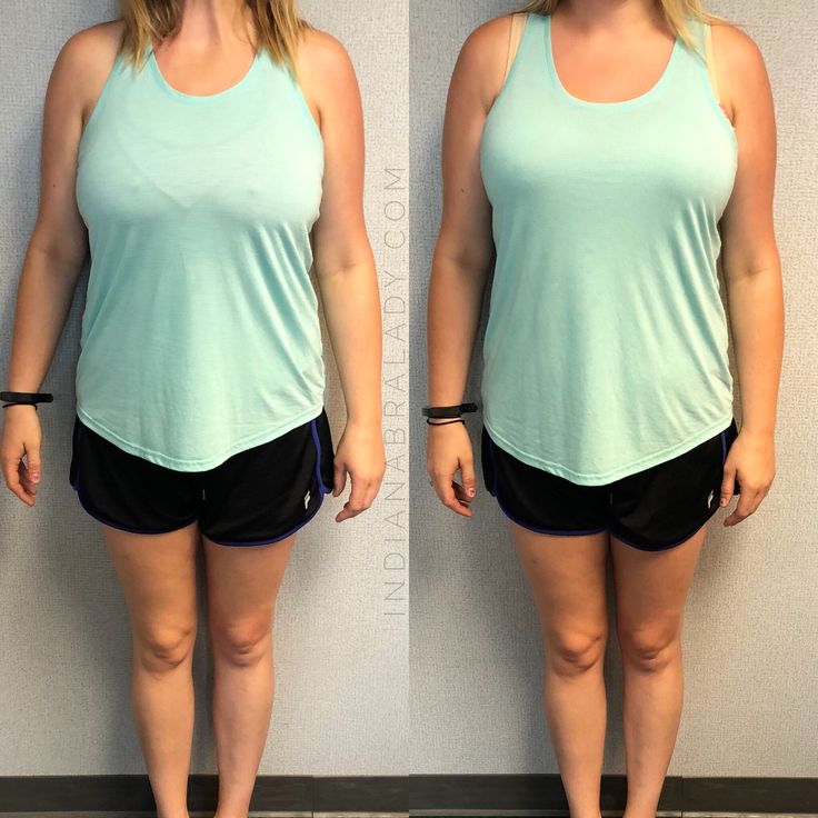 This Incredible 36H Makeover Is Brought To You By The Abbie Bra The this-incredible-36h-makeover-is-brought-to-you-by-the-abbie-bra-the