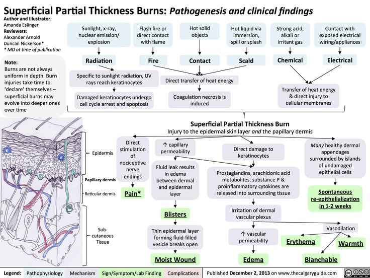 147 best Forensic pathology - burns images on Pinterest Brain - patient note 147 best Forensic pathology - burns images on Pinterest Brain - patient note