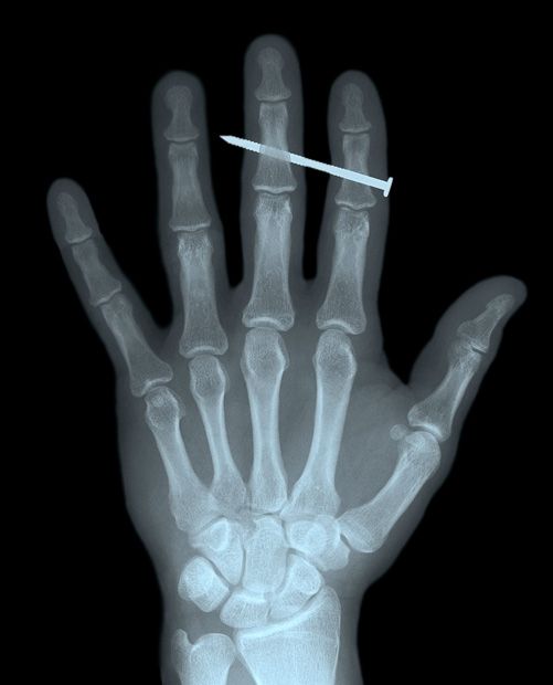 Worlds Weirdest X Rays Worlds Weirdest X Rays