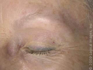the 25 best eyebrow tattoo removal ideas on pinterest manicure the 25 best eyebrow tattoo removal ideas on pinterest manicure