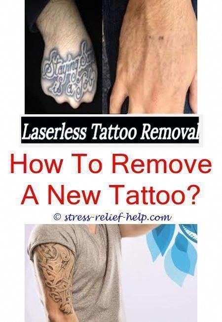 tattoo laser treatment how to remove a tattoo at home without hurting you - lase...