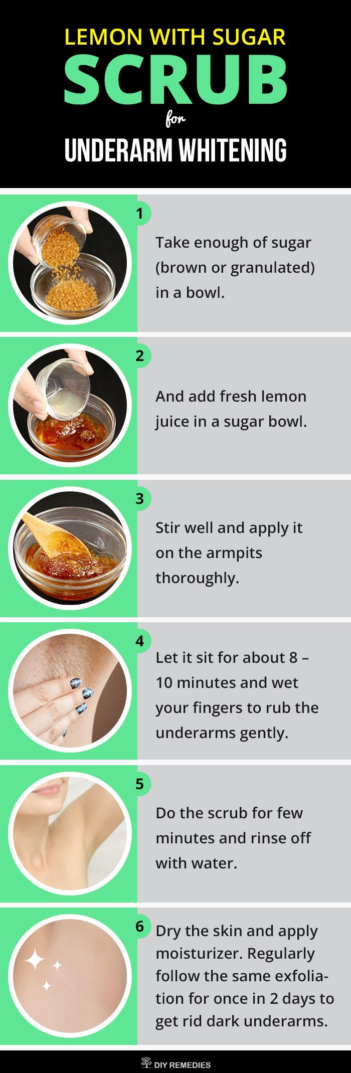 Shugaring: how to make such a procedure yourself Shugaring: how to make such a procedure yourself