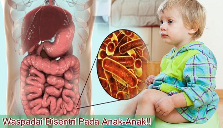 Penyakit Jantung Koroner Terjadi Ketika Pembuluh Darah Utama Yang Mengalir Melalui Jantung Arteri Dan Membawa Oksigen Serta Penyakit Penyakit Jantung Jantung