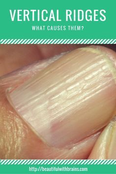 Natural Treatment For Nail Ridges Natural Treatment For Nail Ridges