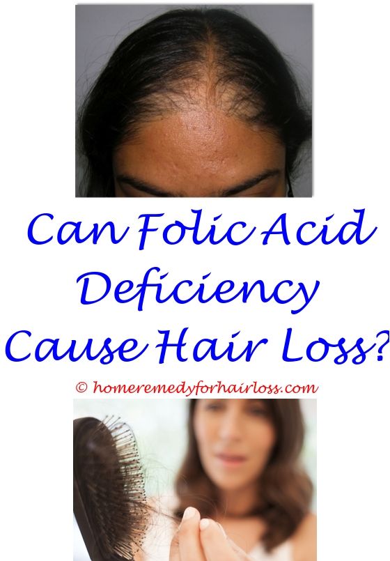 17 best Best Hair Loss Products images on Pinterest
