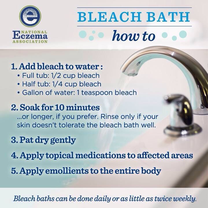 Bleach Bath Recipe For Ezcema Diysugarscrub Sick In 2019 Bleach Bath For Eczema Bleach Bath Eczema Treatment
